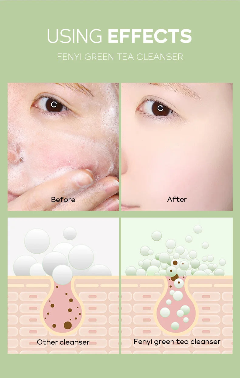 Vitamin C Facial Cleanser – Deep Cleansing & Brightening Foam (150g)