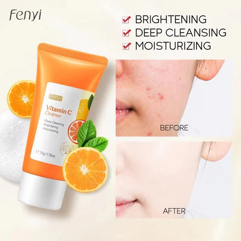 Vitamin C Facial Cleanser – Deep Cleansing & Brightening Foam (150g)